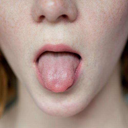 Hoe je tong gevormd is, spreekt boekdelen!