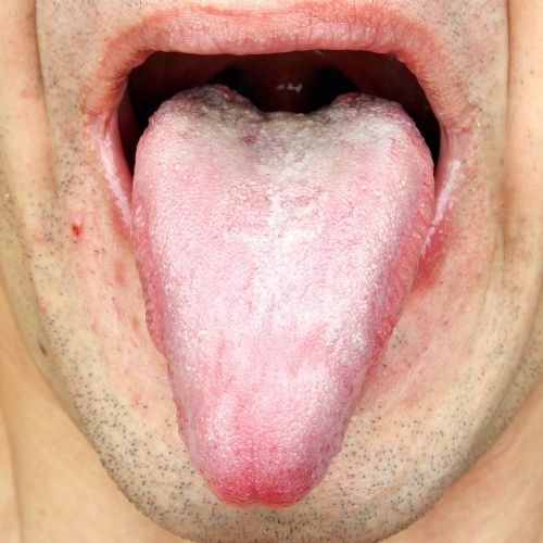 Hou je tong gezond en schraap deze regelmatig