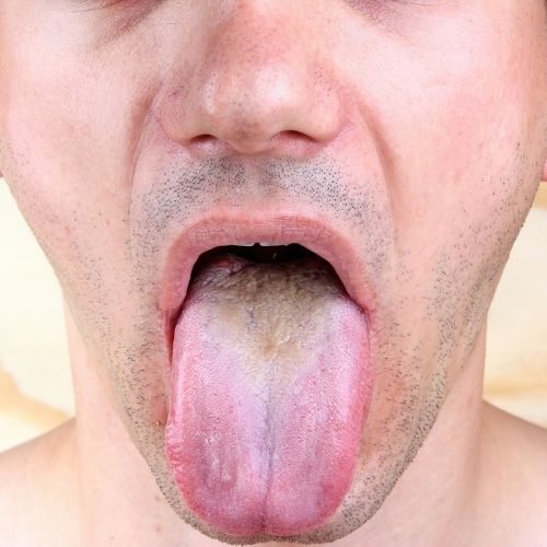 Steek je tong eens uit!