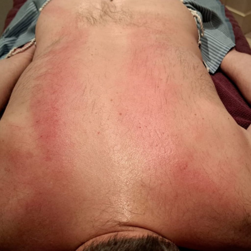 Gua sha